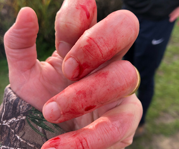 Bleeding Fingers from a pike fishing trip